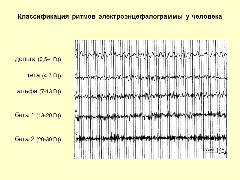 Классификация ритмов электроэнцефалограммы у человека   дельта (0,5-4 Гц)  тета (4-7 Гц)
